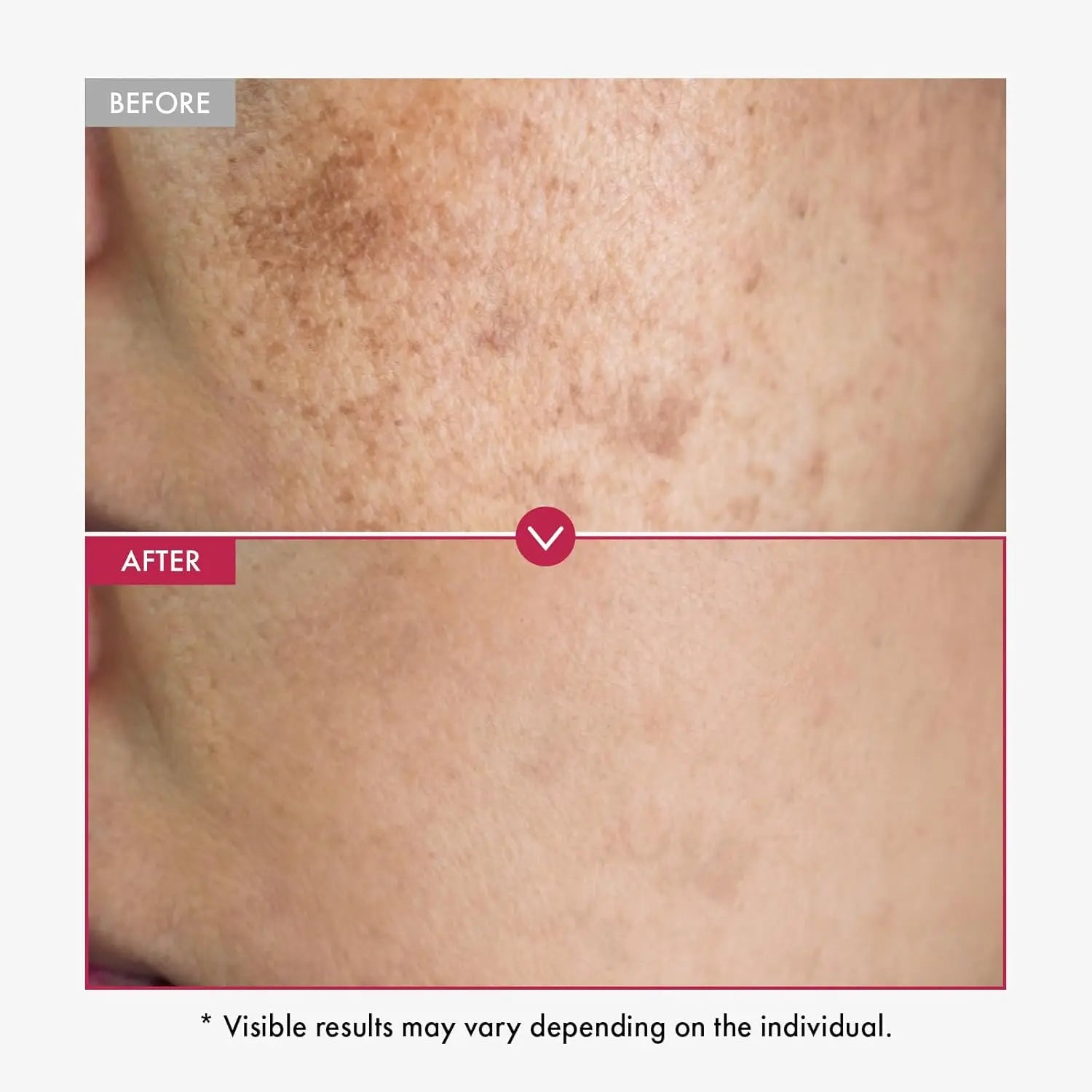 Alpha Arbutin AHA Serum for Brightening and Hydrating Face and Body, Enhancing Radiance in Darker Skin Tones