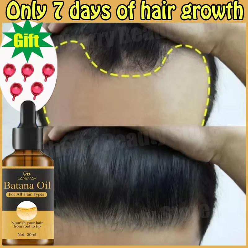 7 Days Fast Batana Oil Hair Growth Serum Anti-Loss Hair Regrowth Products Repair Damaged Hair Roots Hair Care for Women Men